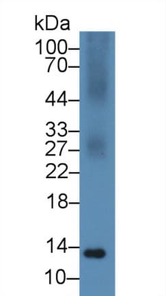 Calgizzarin / S100A11 Antibody (aa1-101)