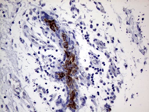AGR2 Antibody (aa21-175, clone OTI1H8)