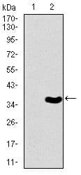 Monoclonal Mouse anti-Human TBXT / T / Brachyury Antibody (clone 1H9A2, Amino Acid: 257-309, IHC, WB)
