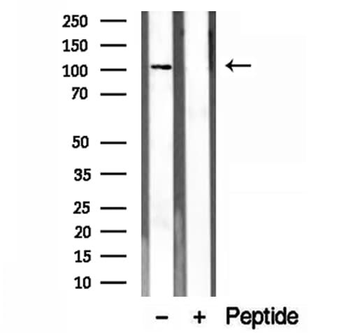 EXOC1 / SEC3 Antibody