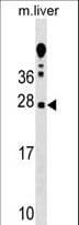 TRAT1 / TRIM Antibody (aa98-127)