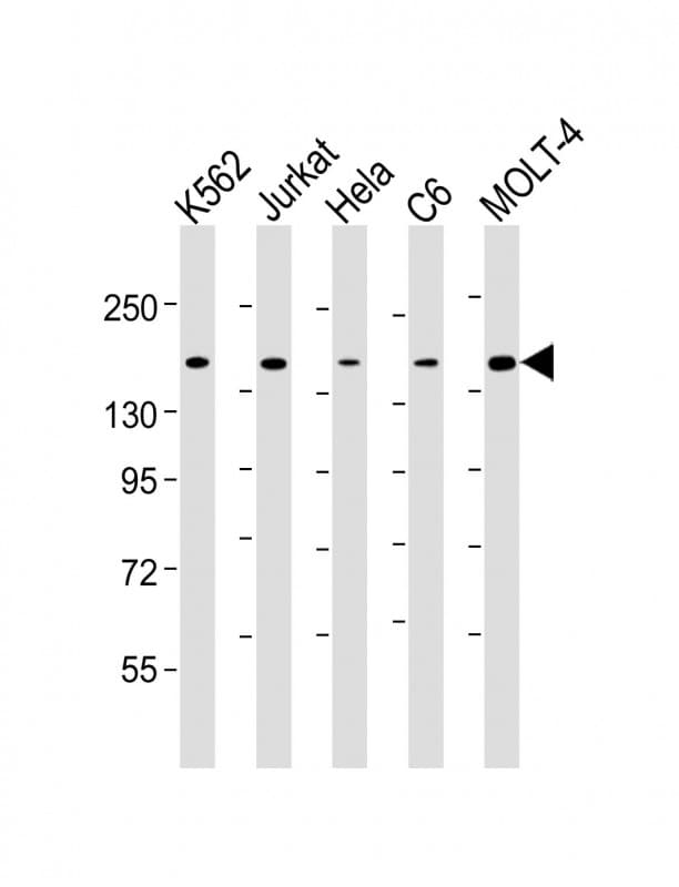 CTCF Antibody (clone 1723CT382.14.9)