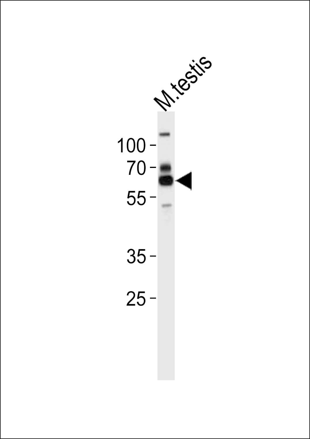 ZSCAN5B Antibody (aa403-431)