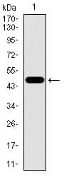 ALDH2 Antibody (aa317-517, clone 4G6A3)