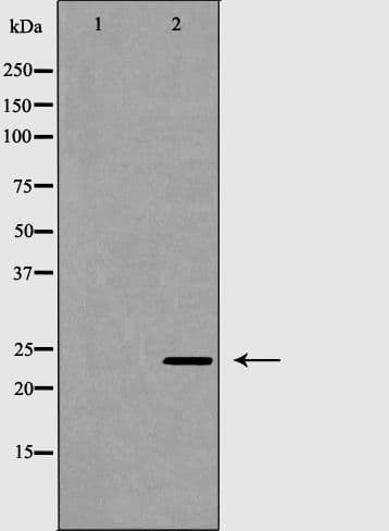 RAB27A / RAB27 Antibody