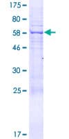 Human KIAA1257 Protein (Recombinant GST)