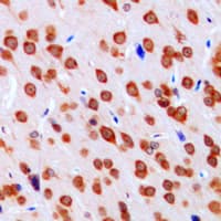 DCLK3 / CLR Antibody (Internal)