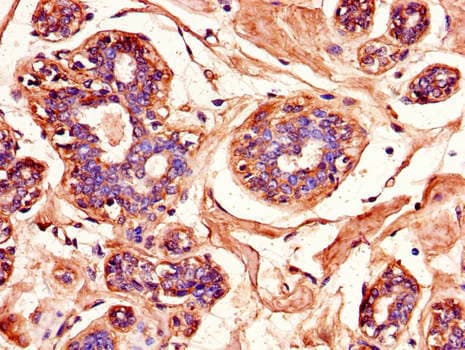 MAPK10 / JNK3 Antibody