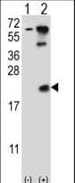 HR6B / UBE2B Antibody (aa117-146)