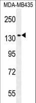 GRIN2A / NMDAR2A / NR2A Antibody (aa1291-1318)