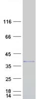 Human SERPINB8 Protein (Recombinant Myc-DDK (Flag))