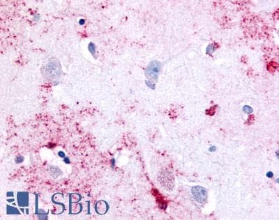 PathPlus™ PAK6 Antibody (Linker Domain)
