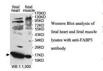 FABP3 / H-FABP Antibody (aa1-133)