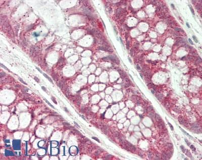 DDIT3 / CHOP Antibody (aa1-169)
