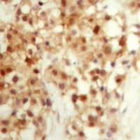 TP53 / p53 Antibody (C-Terminus)