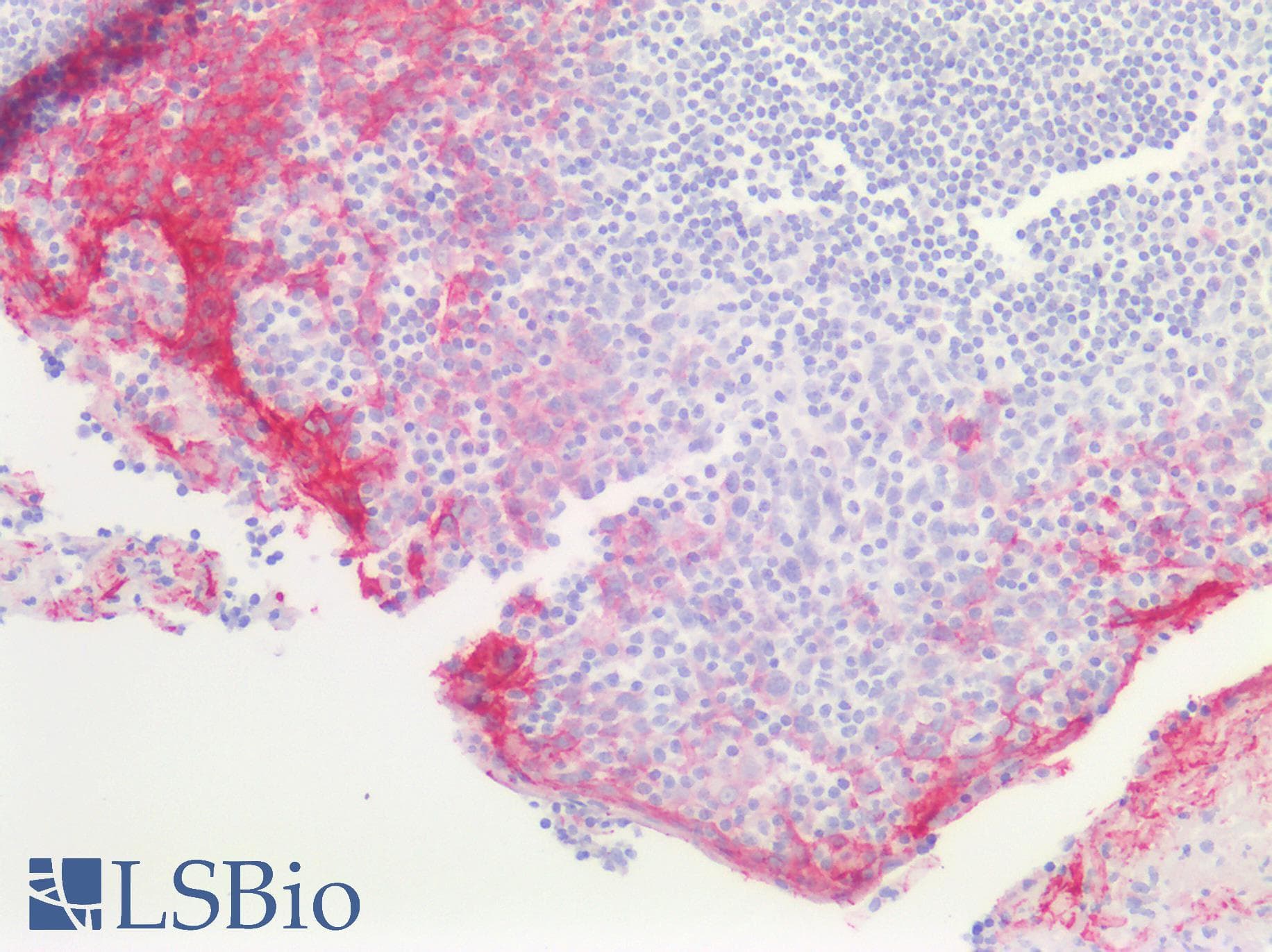 PathPlus™ CLDN4 / Claudin 4 Antibody (aa160-209)