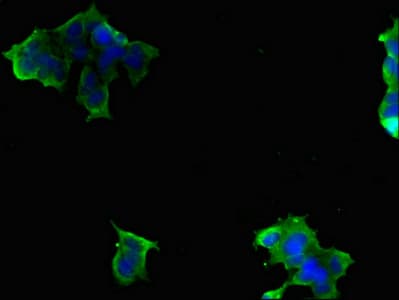 SLC9A6 Antibody