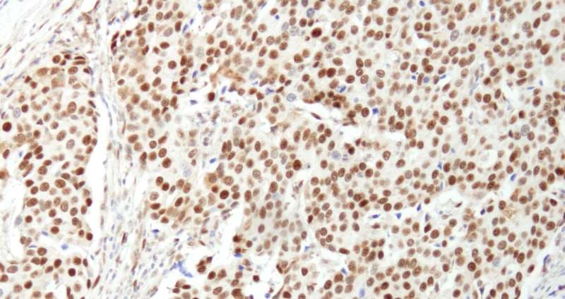 Polyclonal Rabbit anti-Human NUCKS1 Antibody (aa1-50, IHC)