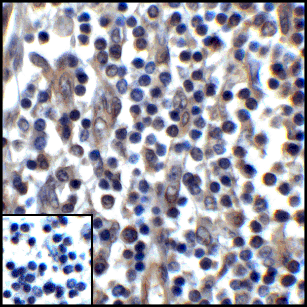 CD274 / B7-H1 / PD-L1 Antibody (clone 1F11)