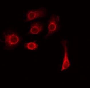 Polyclonal Rabbit anti-Human TMEM185A / FAM11A Antibody (IF, WB)