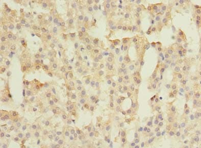 FAM149B1 Antibody