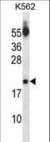 Polyclonal Rabbit anti-Human SAP18 Antibody (aa58-86, WB)