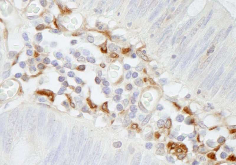 FLNA / Filamin A Antibody (aa1725-1775)