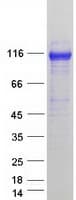 Human AP1B1 / BAM22 Protein (Recombinant Myc-DDK (Flag))