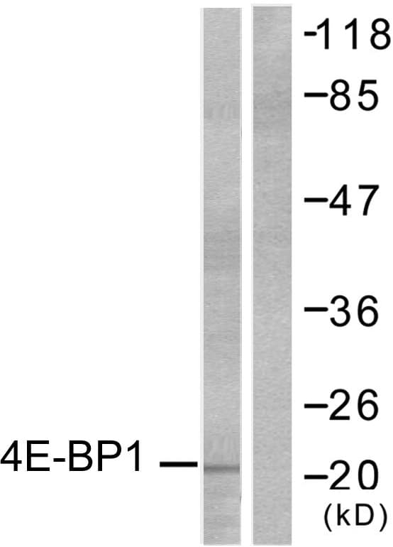 EIF4EBP1 / 4EBP1 Antibody (aa4-53)
