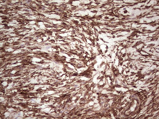 LGALS9 / Galectin 9 Antibody (clone OTI1D12)