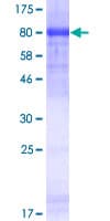 Human HDAC1 Protein (Recombinant GST)