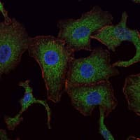 Monoclonal Mouse anti-Human RAB25 Antibody (clone 3F12, IHC, IF, WB)