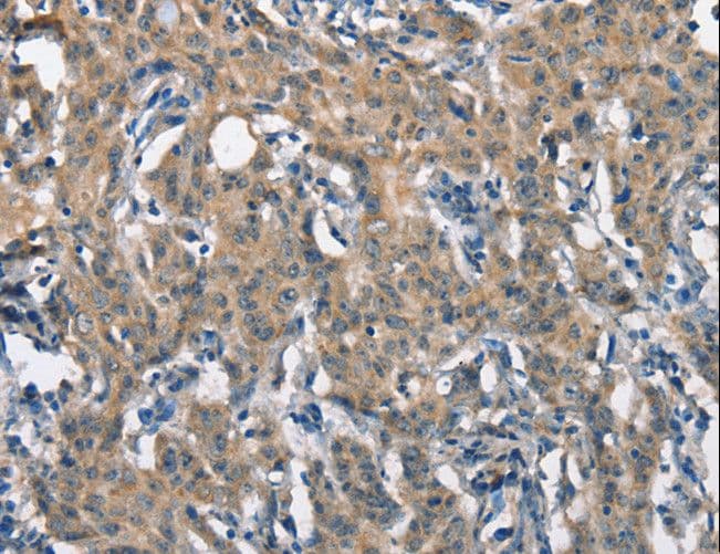 SCARB1 / SR-BI Antibody