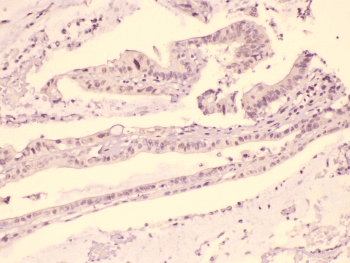 HDGF Antibody