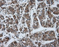 LIPG / Endothelial Lipase Antibody (clone OTI5C3)