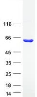 Human ASPG Protein (Recombinant Myc-DDK (Flag))
