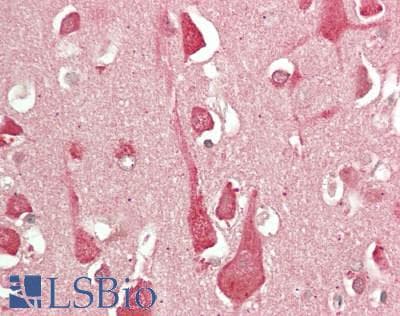 IHC-plus™ ORAI3 Antibody (clone 2H2G9)