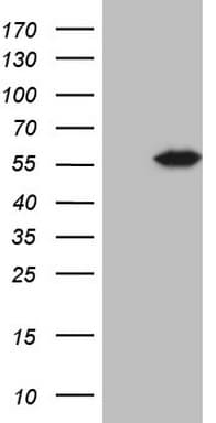 Monoclonal Mouse anti-Human ABAT Antibody (clone OTI7E9, Carrier-free, aa29-323, IHC, WB)