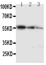 MKI67 / Ki67 Antibody (aa3234-3256)