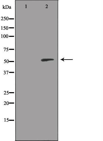 RSAD1 Antibody