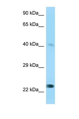 MMP20 Antibody (aa396-445)