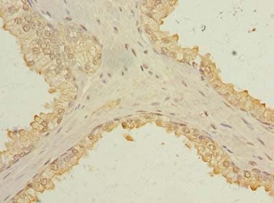 Polyclonal Rabbit anti-Human C1orf182 Antibody (IHC)