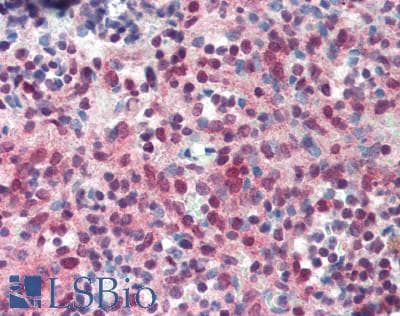 IHC-plus™ Polyclonal Rabbit anti-Human PPARG / PPAR Gamma Antibody (IHC, WB)