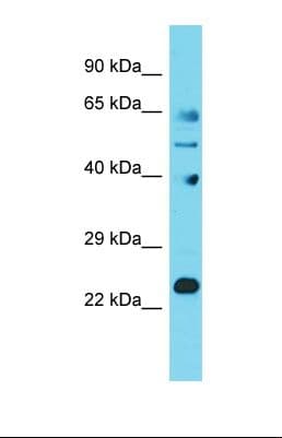Polyclonal Rabbit anti-Human JOSD1 Antibody (N-Terminus, WB)
