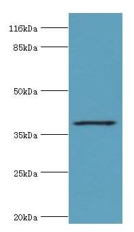 HAVCR1 / KIM-1 Antibody (aa21-290)