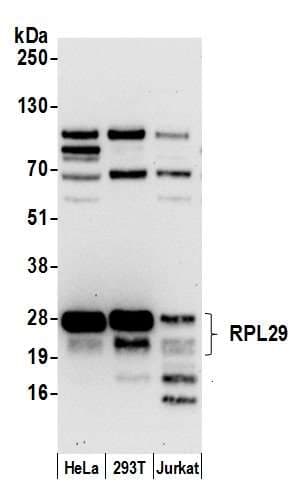 RPL29 / Ribosomal Protein L29 Antibody (aa109-159)