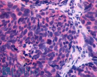 PathPlus™ CXCR4 Antibody (Cytoplasmic Domain)