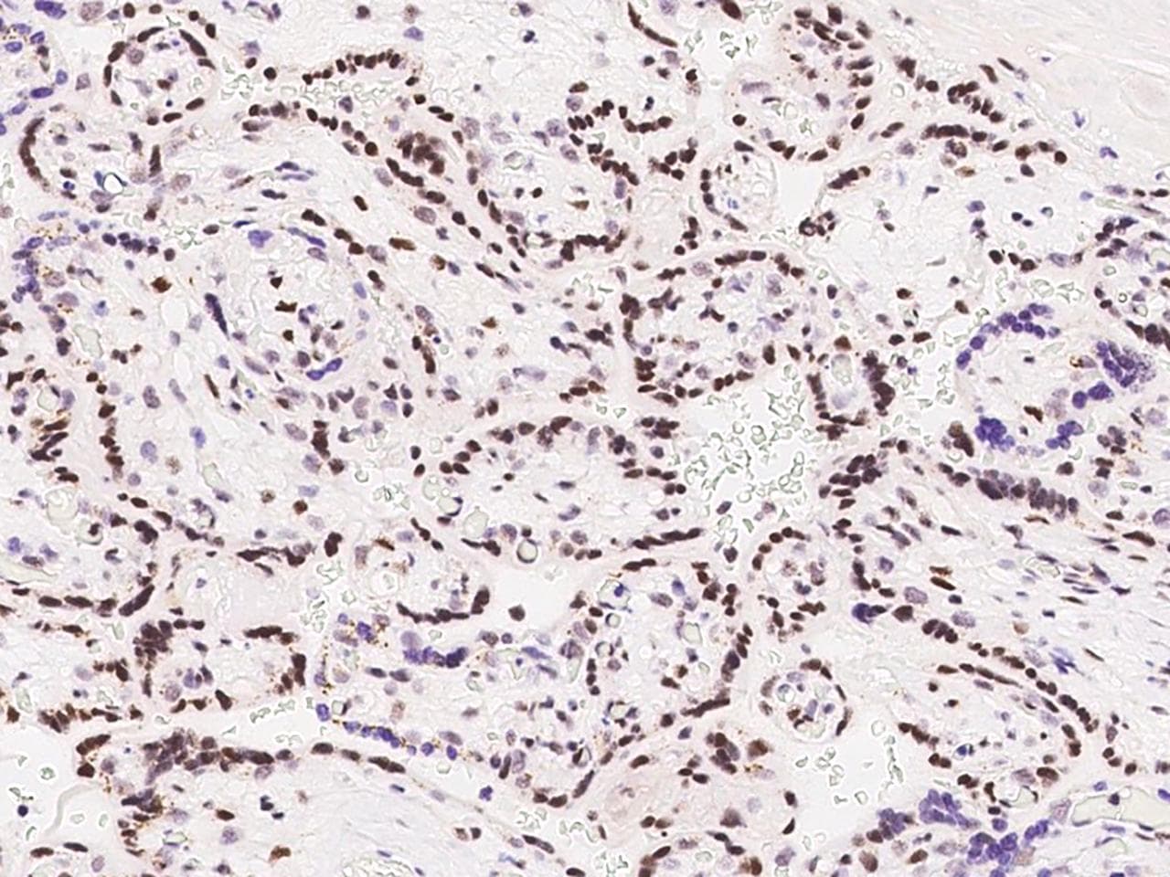 MEF2D Antibody
