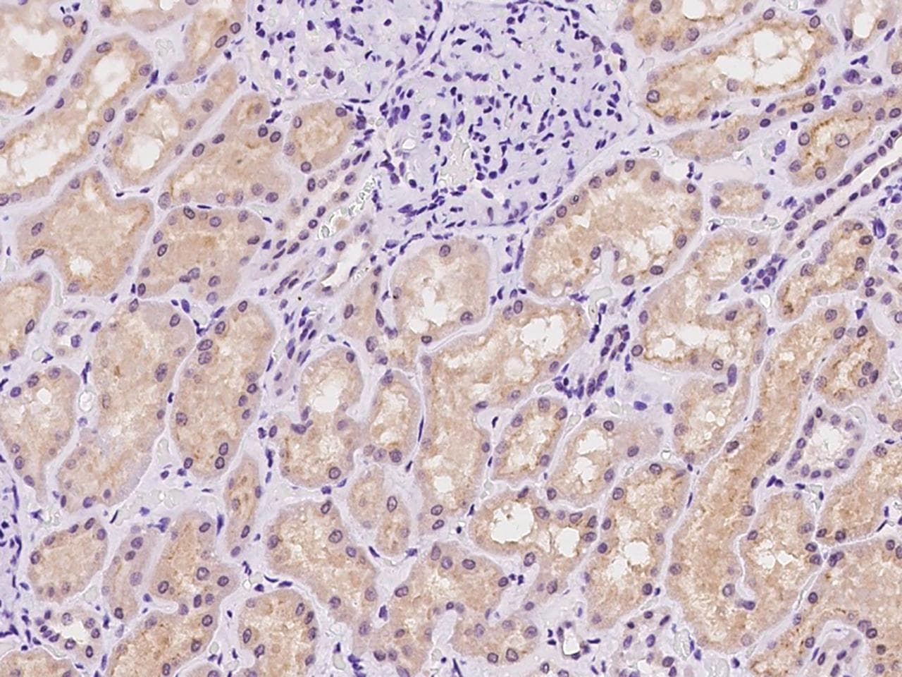 Polyclonal Rabbit anti-Human SLC25A41 Antibody (IHC)