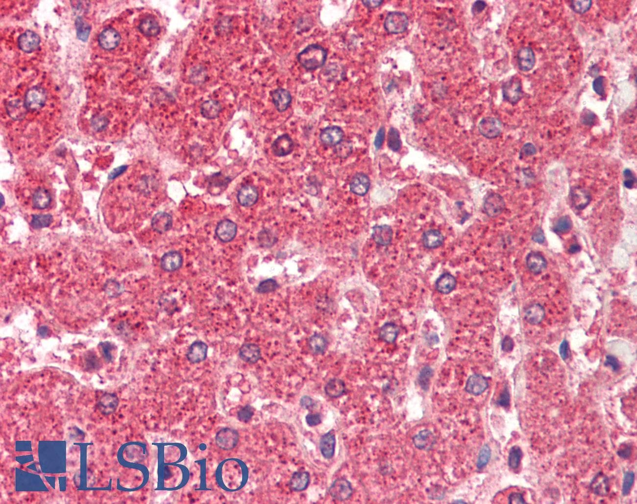 IHC-plus™ Polyclonal Goat anti-Human ALDH5A1 Antibody (aa485-496, IHC, WB)
